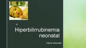 z Hiperbilirrubinemia neonatal Icteria Neonatal z z CONCEPTO