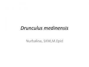Drunculus medinensis Nurhalina SKM M Epid Pendahuluan Filaria