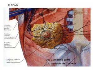 BIRADS BIRADS BIRADS CLASIFICACION BIRADS v Breast Imaging