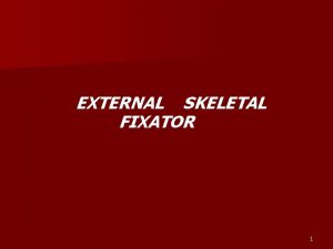 EXTERNAL SKELETAL FIXATOR 1 EXTERNAL SKELETAL FIXATORS n