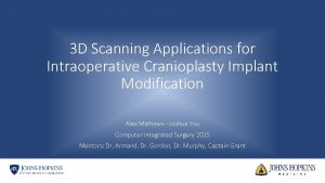 3 D Scanning Applications for Intraoperative Cranioplasty Implant