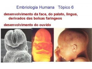 Embriologia Humana Tpico 6 desenvolvimento da face do