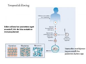 Terapeutisk kloning Siden cellene har pasientens eget arvestoff