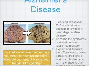 Alzheimers Disease Learning Intentions 1 Define Alzheimers disease