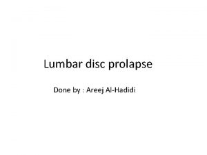 Lumbar disc prolapse Done by Areej AlHadidi Anatomy