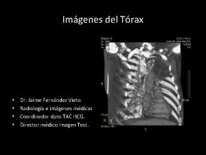 Imgenes del Trax Dr Jaime Fernndez Vieto Radiologa