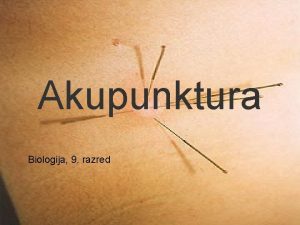 Akupunktura Biologija 9 razred Uvod Akupunktura je oblika