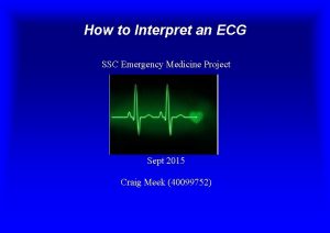 How to Interpret an ECG SSC Emergency Medicine