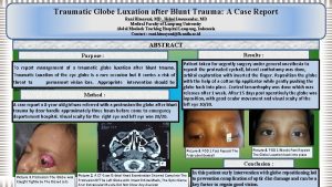 Traumatic Globe Luxation after Blunt Trauma A Case