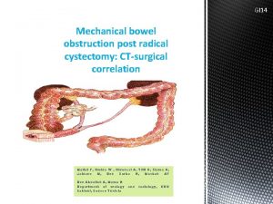 GI 14 Mechanical bowel obstruction post radical cystectomy