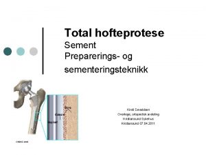 Total hofteprotese Sement Preparerings og sementeringsteknikk Kirsti Sevaldsen