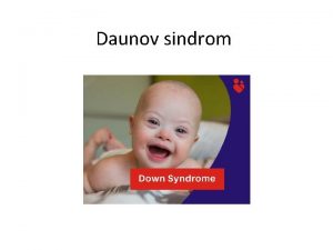 Daunov sindrom ta je Daunov sindrom Genetski poremeaj
