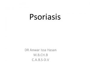 Psoriasis DR Anwar Issa Hasan M B CH