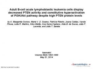 Adult Bcell acute lymphoblastic leukemia cells display decreased