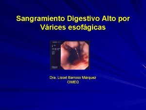 Sangramiento Digestivo Alto por Vrices esofgicas Dra Lisset