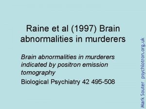 Brain abnormalities in murderers indicated by positron emission