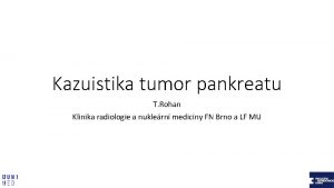 Kazuistika tumor pankreatu T Rohan Klinika radiologie a