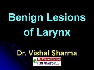 Benign Lesions of Larynx Dr Vishal Sharma Common