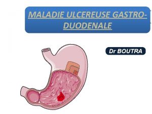 ULCEREUSE MALADIE ULCEREUSE GASTRODUODENALE GASTRODUODENALE Dr BOUTRA INTRODUCTION