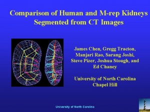 Comparison of Human and Mrep Kidneys Segmented from