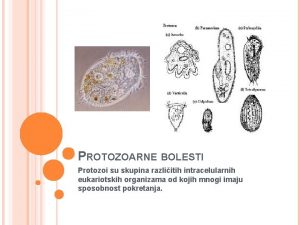 PROTOZOARNE BOLESTI Protozoi su skupina razliitih intracelularnih eukariotskih