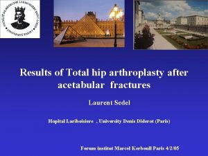 Results of Total hip arthroplasty after acetabular fractures