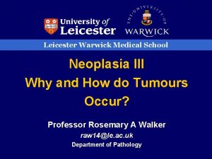 Leicester Warwick Medical School Neoplasia III Why and