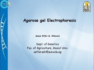 Agarose gel Electrophoresis Ameer Effat M Elfarash Dept