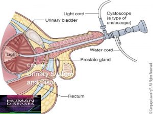 Chapter 13 Urinary System Diseases and Disorders Copyright