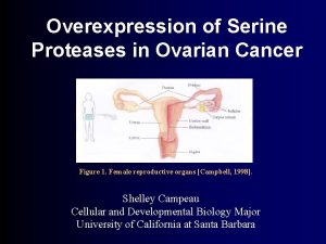 Overexpression of Serine Proteases in Ovarian Cancer Figure