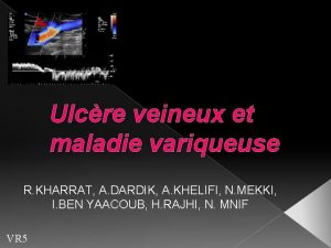 Ulcre veineux et maladie variqueuse R KHARRAT A