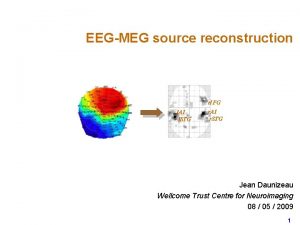 EEGMEG source reconstruction r IFG l A 1