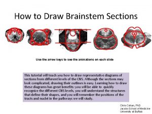 How to Draw Brainstem Sections Use the arrow