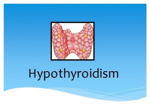 Hypothyroidism Hasan AYDIN MD Yeditepe University Medical Faculty