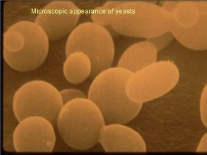 Microscopic appearance of yeasts Molds hyphal structure Tinea