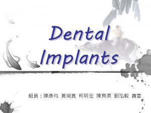 introduction Dental Implant Defination dental implant is also