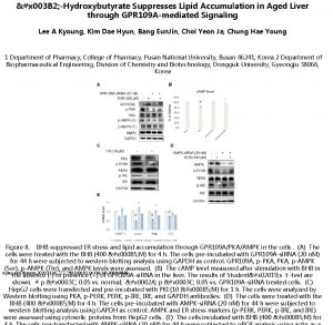 x 003 B 2 Hydroxybutyrate Suppresses Lipid Accumulation