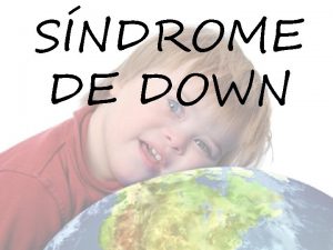 SNDROME DE DOWN INTRODUCCIN El Sndrome de Down