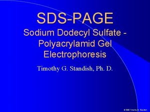 SDSPAGE Sodium Dodecyl Sulfate Polyacrylamid Gel Electrophoresis Timothy
