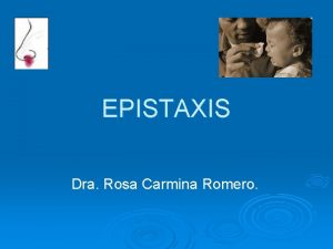 EPISTAXIS Dra Rosa Carmina Romero Anatoma Vascular de