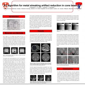 An algorithm for metal streaking artifact reduction in