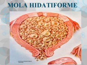 MOLA HIDATIFORME Evoluo Normal da Gestao Ciclo Menstrual