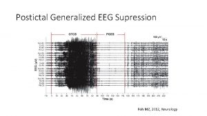 Postictal Generalized EEG Supression Poh MZ 2012 Neurology