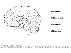 1 lateral fissure 3 pars orbitalis 5 pars