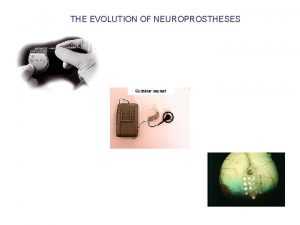 THE EVOLUTION OF NEUROPROSTHESES Lawrence Livermore Flexible Silicone