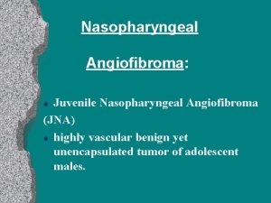 Nasopharyngeal Angiofibroma Juvenile Nasopharyngeal Angiofibroma JNA l highly
