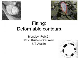 Fitting Deformable contours Monday Feb 21 Prof Kristen