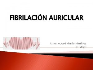 FIBRILACIN AURICULAR Antonio Jos Martnez R 1 MFy