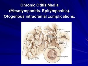 Chronic Otitis Media Mesotympanitis Epitympanitis Otogenous intracranial complications