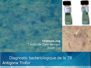 Diagnostic bacteriologique de la TB Antigona Trofor Examen